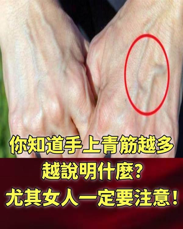 你知道手上青筋越多，越說明什麼？尤其女人一定要注意！