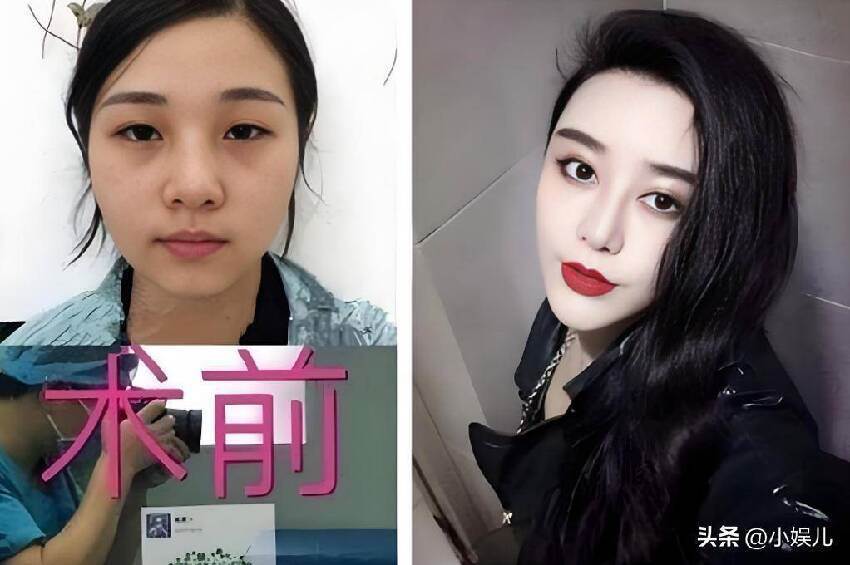 富家女花800萬改臉成范冰冰，嫁主刀醫生，9年後近況曝光引關注