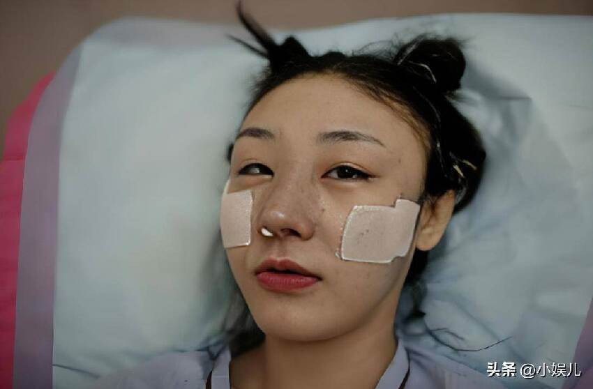 富家女花800萬改臉成范冰冰，嫁主刀醫生，9年後近況曝光引關注