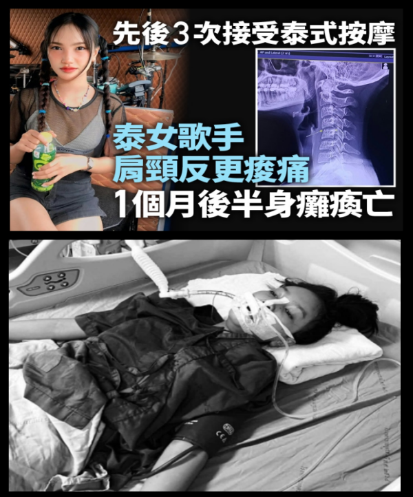 女歌手去按摩「半身癱瘓」　一個月後身 亡