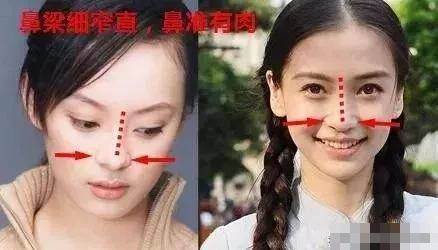 鼻子上有「一根線」的女人，非富即貴，是好老婆面相，能娶到富貴一生！