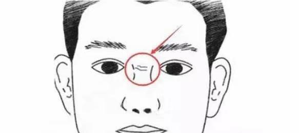從面相看疾病，出現10大危險信號別當小事，現在看還來得及！