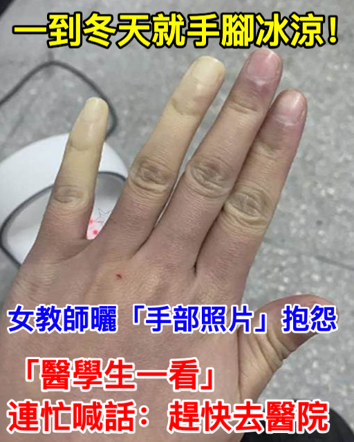 一到冬天就手腳冰涼！女教師曬「手部照片」抱怨　「醫學生一看」連忙喊話：趕快去醫院