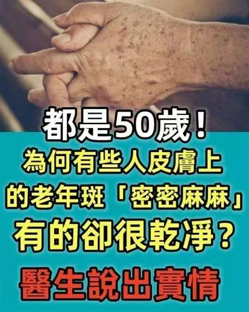 都是50歲 為什麼有的人乾乾凈凈，有的人卻長滿密密麻麻的老年斑？