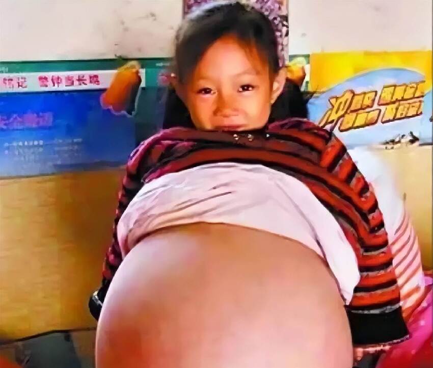 4歲女童腹大如孕，被醫判僅剩3個月！父母絕望之際，房東大姐「1句話」救了她