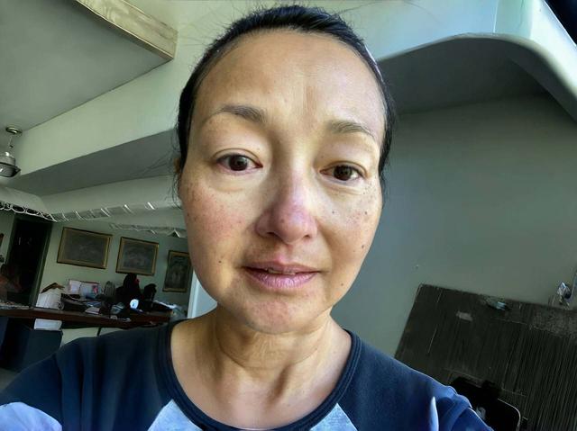 香港知名女星復出拍戲,滿臉雀斑頸紋明顯,拒絕整容想自然老去