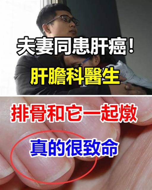 夫妻同患肝癌！肝膽科醫生「排骨和它一起燉」真的很致命