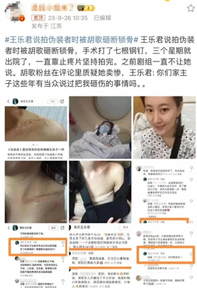 女星自曝被胡歌砸斷鎖骨，手術打七根鋼釘！曾被劇組封口，遭質疑暗示胡歌不紅