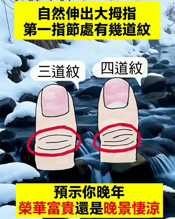 自然伸出大拇指，第一指節處有幾道紋？