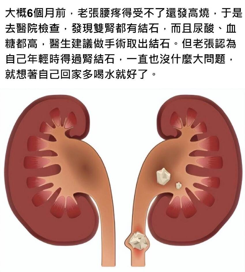 男子尿酸值600，不幸腎衰竭離世，勸告：4種食物再愛吃也要管住嘴