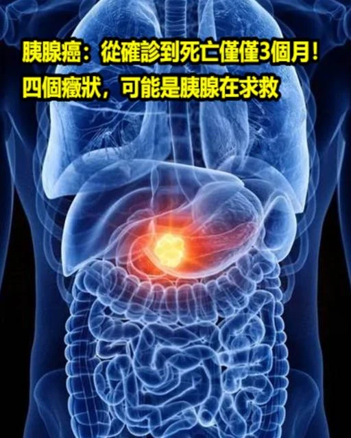 胰腺癌：從確診到死亡僅僅3個月！四個症狀，可能是胰腺在求救~