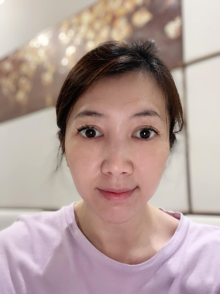 家庭爆發衝突!49歲八點檔女星驚吐「遭媽媽拿菜刀砍傷」獨自就醫 「忍痛縫完21針」肌腱差點不保
