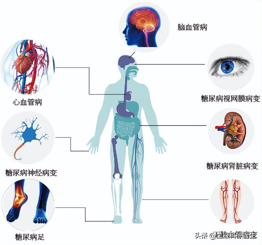 50歲大叔血糖「從14.5降到5.2」！醫生認證：他的「3個降糖習慣」值得學習