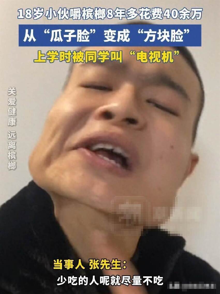 18歲少年嚼檳榔8年！瓜子臉慘變「方塊臉」，網驚：以為是特效