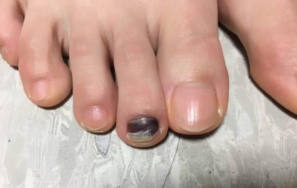 注意！男女這裡「變黑」暗示你要生重病了...甚至會影響生命安全！太可怕了！