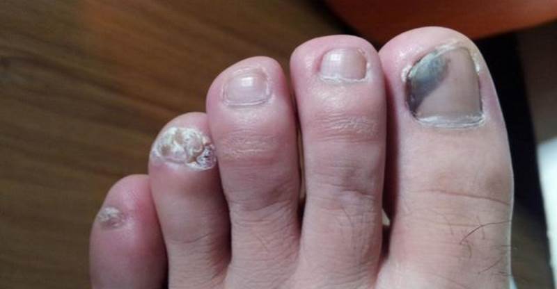 注意！男女這裡「變黑」暗示你要生重病了...甚至會影響生命安全！太可怕了！