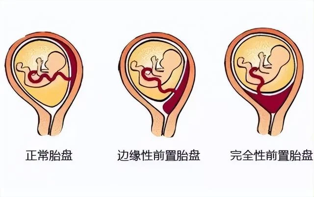 白天生孩子和晚上生孩子有2大不同，醫生：不是迷信，有科學依據