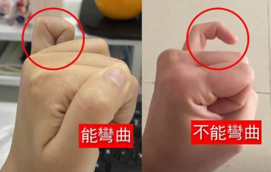 小拇指能不能彎曲，預示晚年「福命還是苦命」：太準了