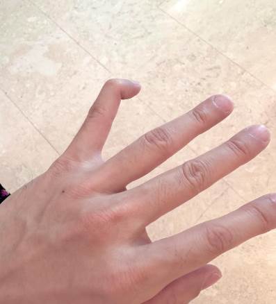 小拇指能不能彎曲，預示晚年「福命還是苦命」：太準了